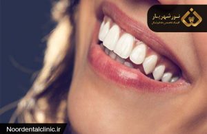 دندانپزشکی زیبایی