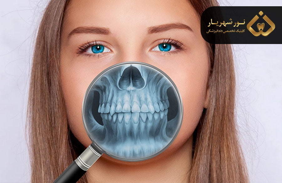 هزینه جراحی زیبایی فک و صورت