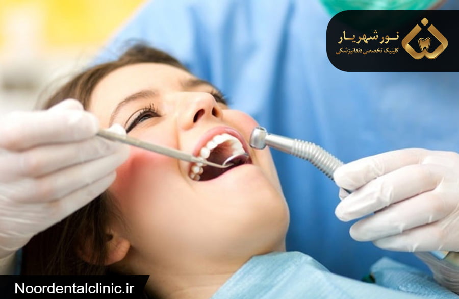 عصب کشی دندان