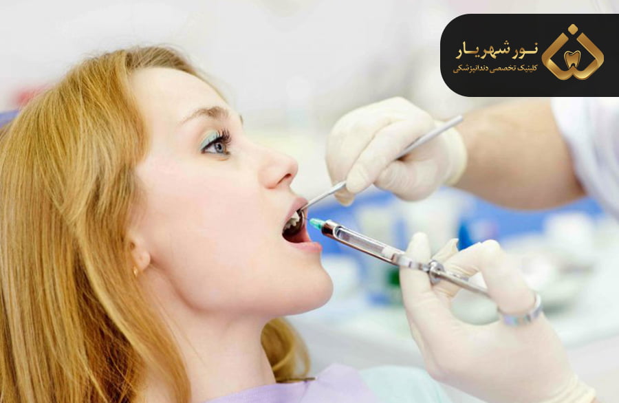 ماندگاری دندان عصب کشی