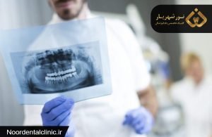 درمان ریشه دندان