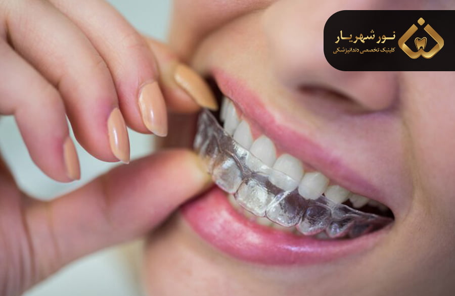 ارتودنسی نامرئی چیست؟