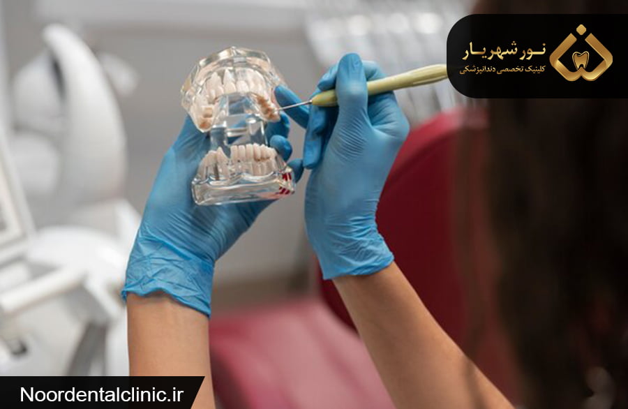 چیزهایی مهمی که در مورد ارتودنسی نامرئی به شما گفته نشده