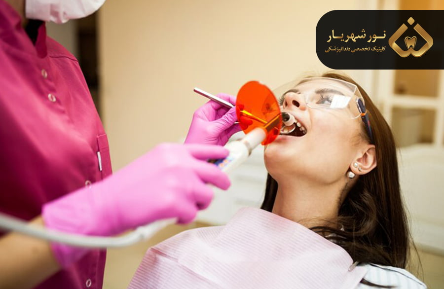 جرم گیری یا بروساژ دندان چیست؟