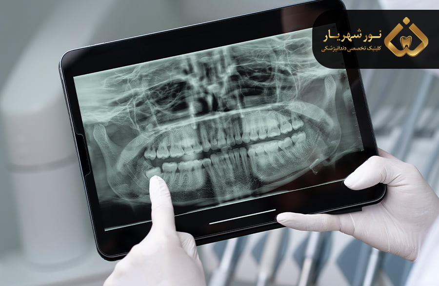 رادیو لوژی دهان، دندان، فک و صورت