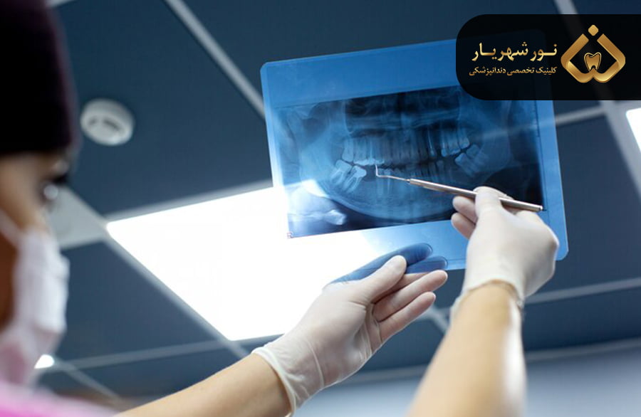 قیمت رادیولوژی دهان و دندان
