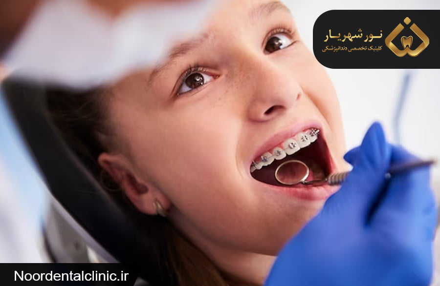 مراحل ارتودنسی دندان توسط متخصص ارتودنسی و جراحی فک