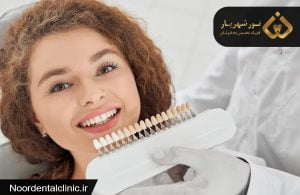 روکش دندان چیست و چه کاربردهایی دارد؟