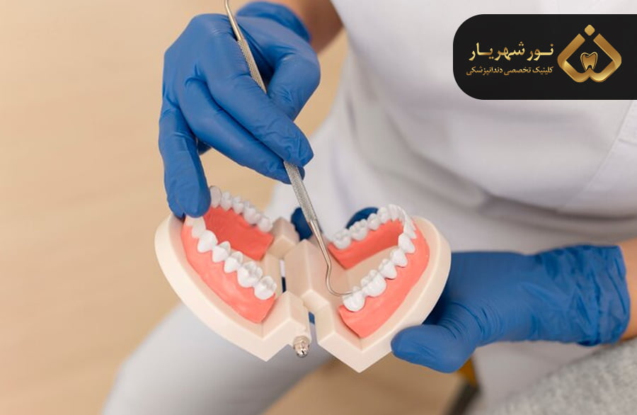 هزینه دندان مصنوعی