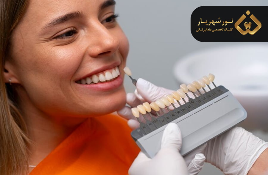 فرق کامپوزیت و لمینت دندان چیست؟