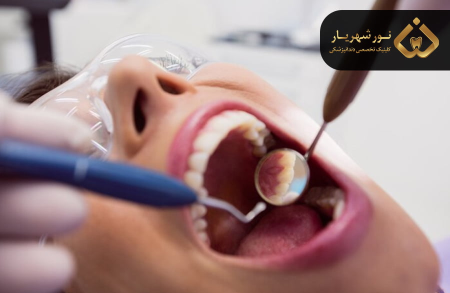 درد بعد از کشیدن دندان تا چند روز طبیعی است؟