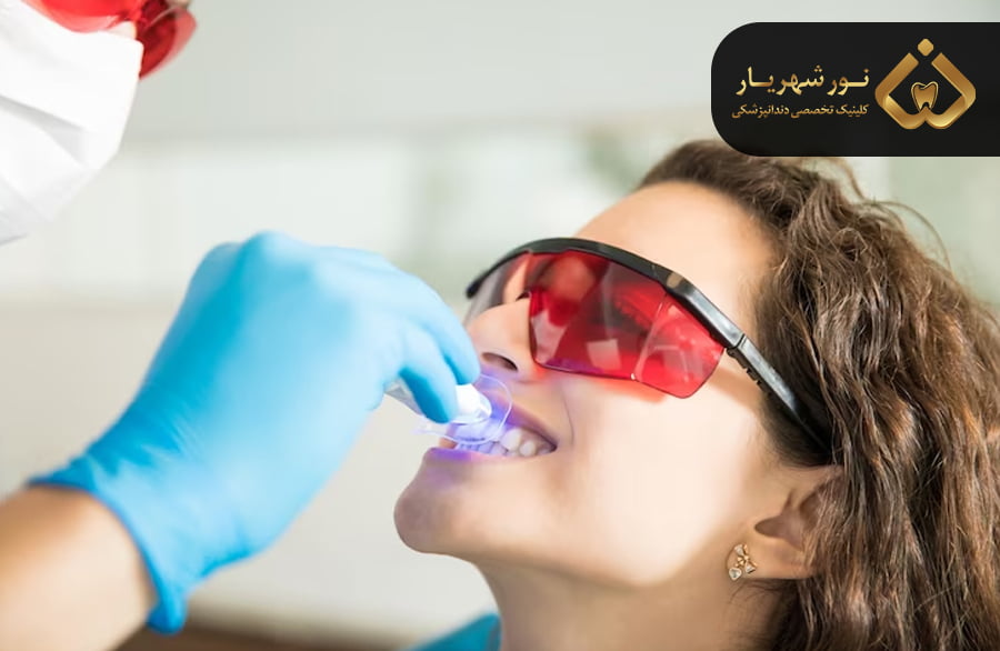 سفید کردن دندان (بلیچینگ)