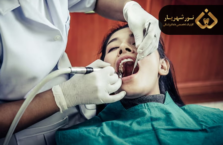 سخن نهایی در مورد درمان ریشه دندان