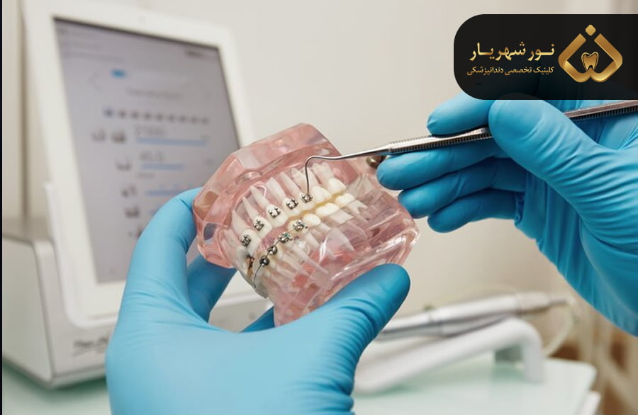 مراقبت های بعد از ارتودنسی دندان