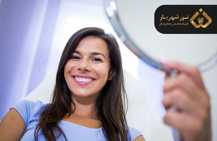 لمینت دندان چیست و چگونه انجام می‌شود؟