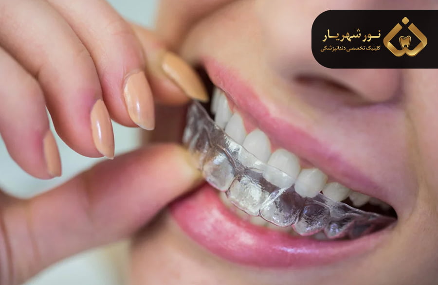 ارتودنسی اینویزیلاین چیست؟