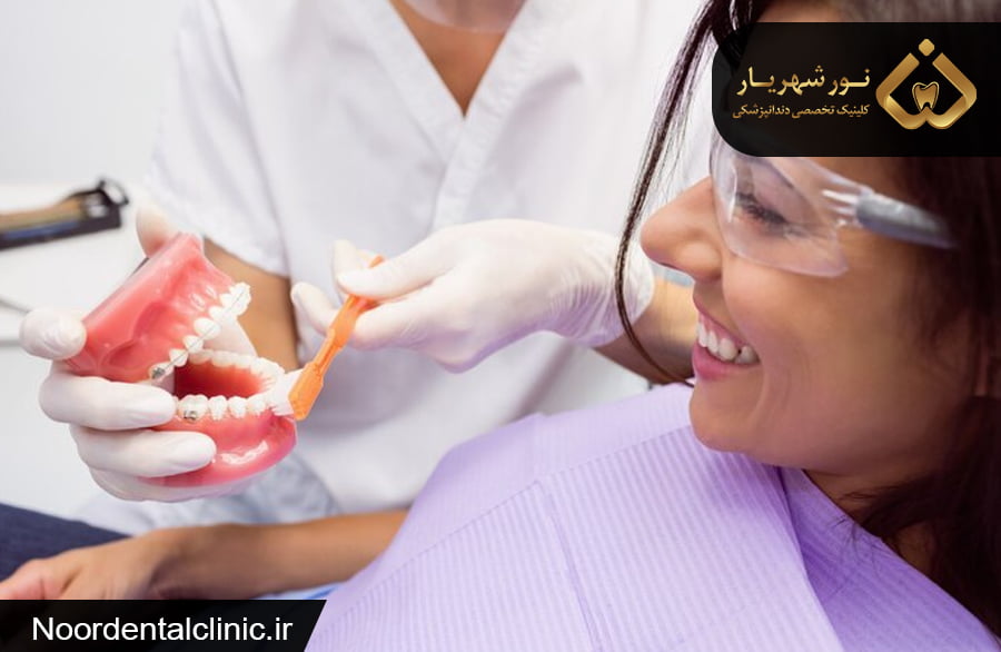 ترمیم و بازسازی دندان در شهریار| انواع روش‌های ترمیم دندان