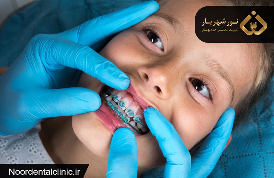 ارتودنسی کودکان در شهریار|ارتودنسی کودکان و بزرگسالان اندیشه