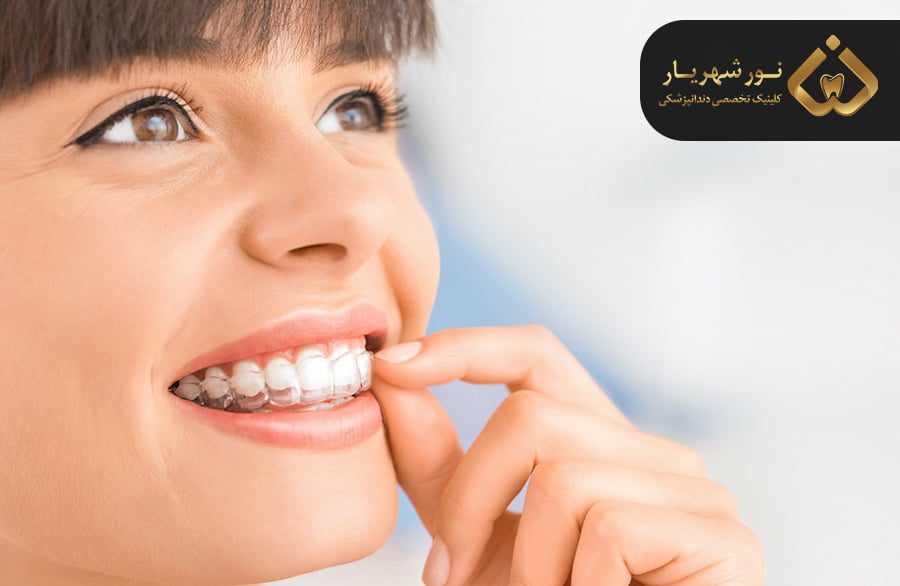 هزینه ارتودنسی اینویزیلاین