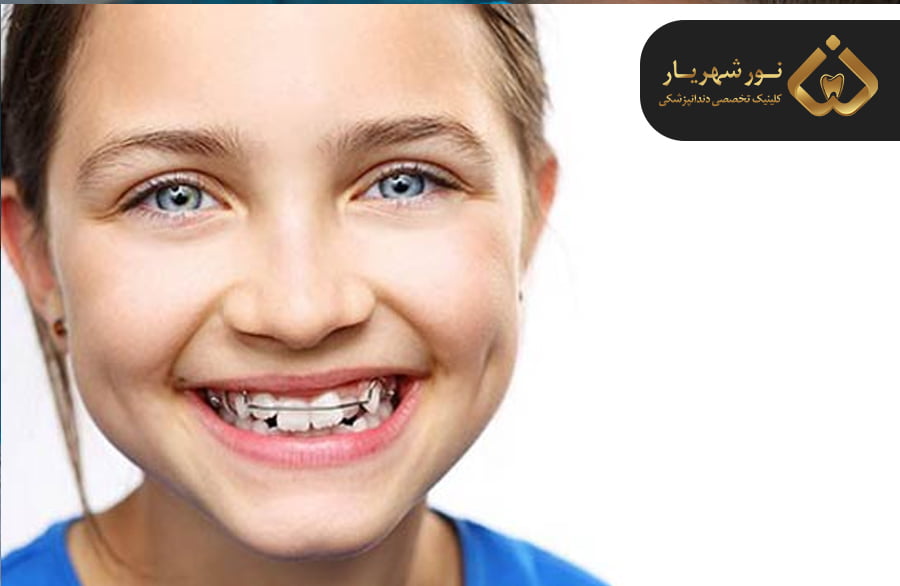 مراقبت های بعد از ارتودنسی کودکان
