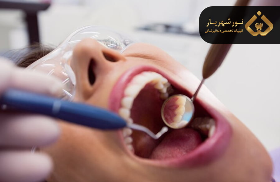 ترمیم دندان چیست؟