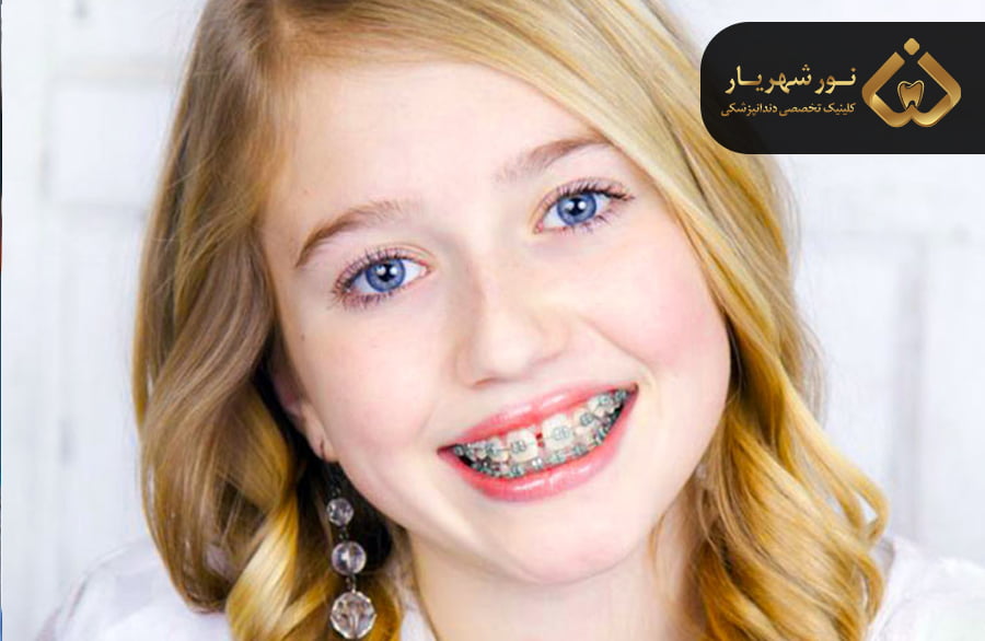 ارتودنسی کودکان در کوتاه ترین زمان زیر نظر متخصص