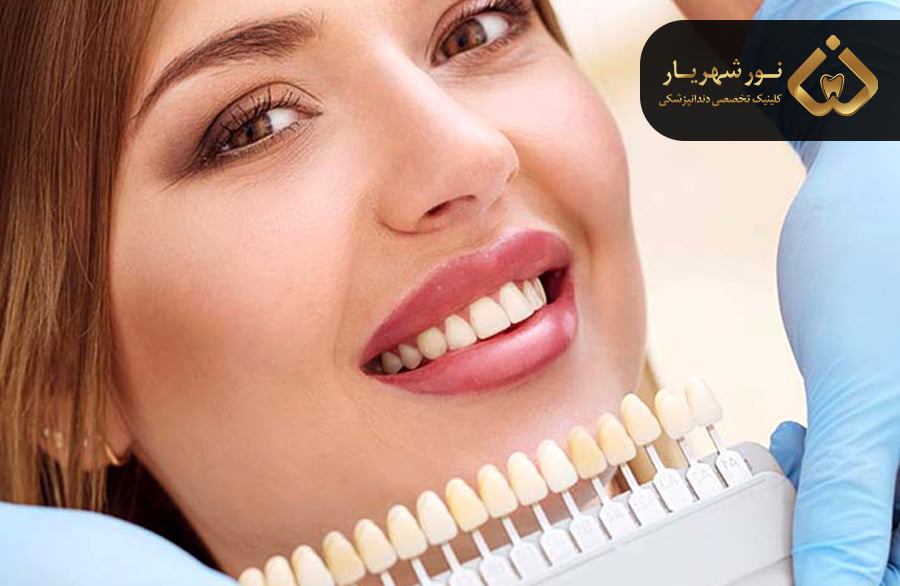 کامپوزیت دندان برای چه کسانی مناسب است؟