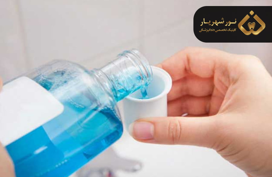 هزینه و قیمت فلوراید تراپی کودکان