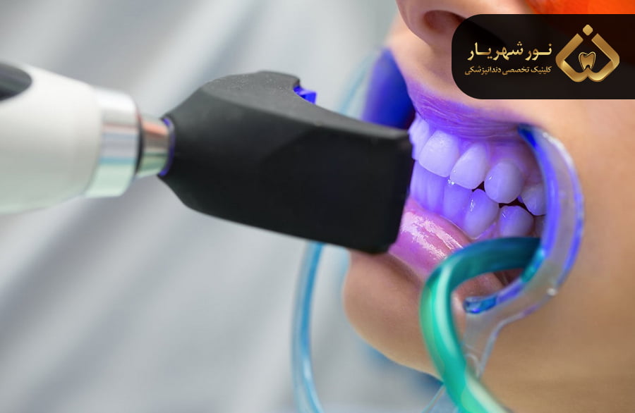 مزایای جرم گیری و بلیچینگ