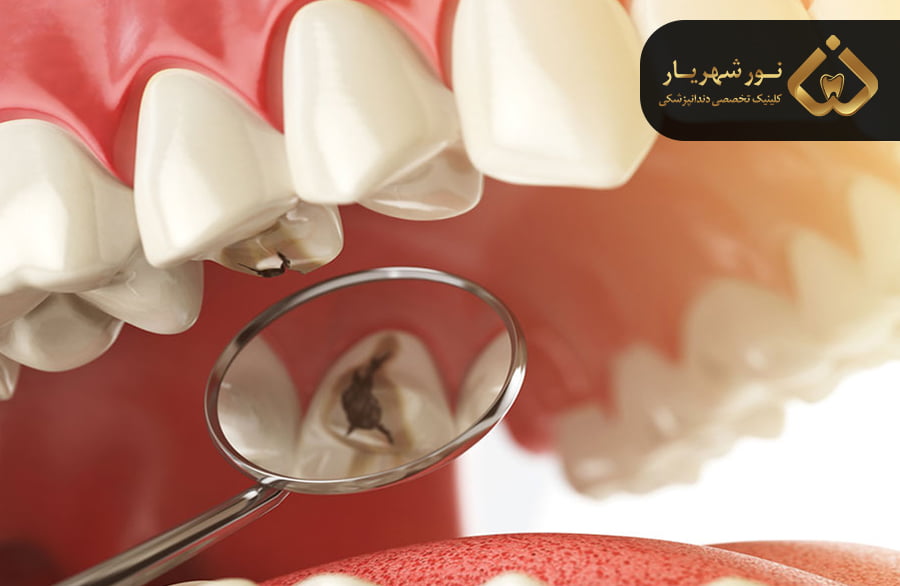 راه های کنترل رفلاکس معده و اجتناب از تأثیرات مخرب آن