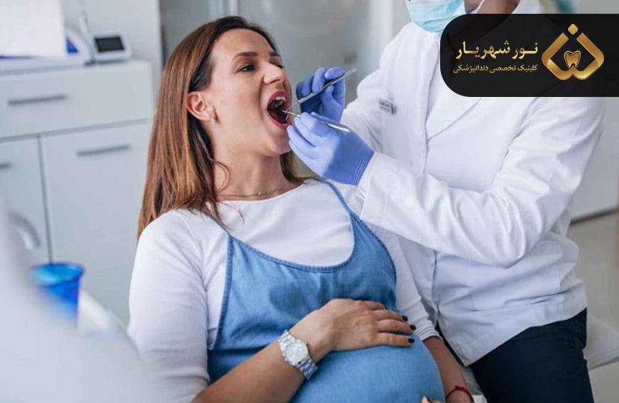 کشیدن دندان در زمان های متفاوت بارداری
