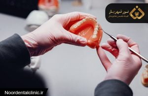 علت درد دندان بعد از روکش دندان چیست و درمان آن