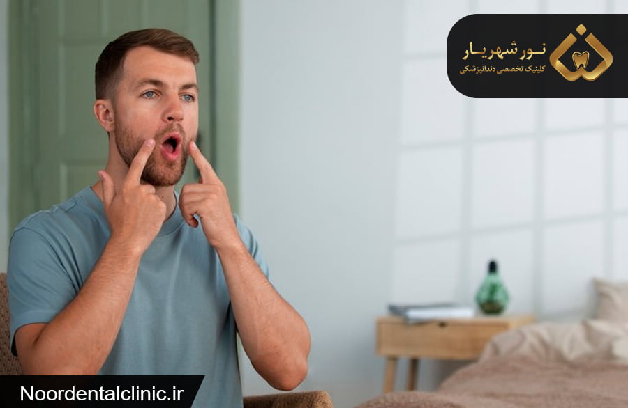 آفت و زخم های دهانی و زبان و روش درمان آن ها
