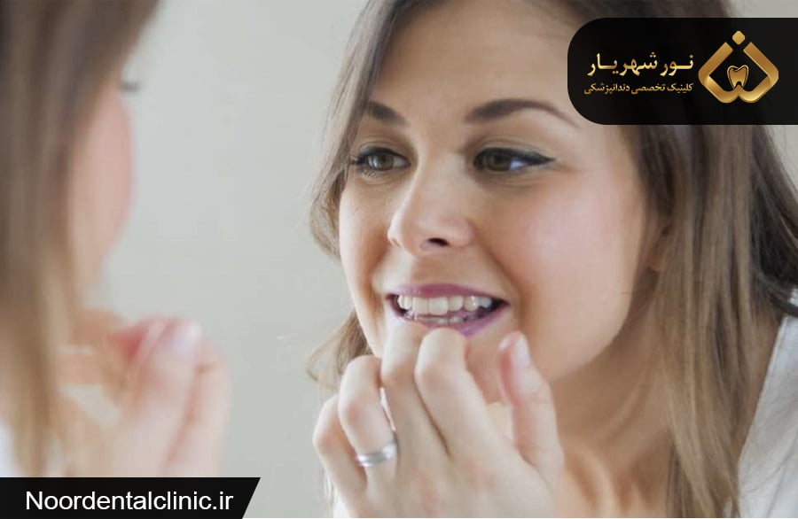 دلایل لقی دندان در بزرگسالان و روند ترمیم و درمان آن