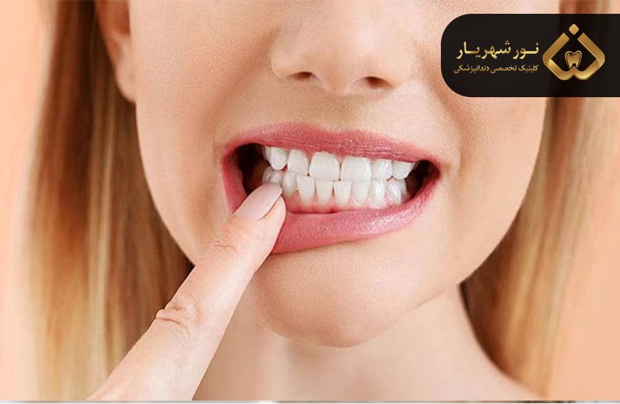 عواقب بی توجهی به از دست دادن دندان های دائمی