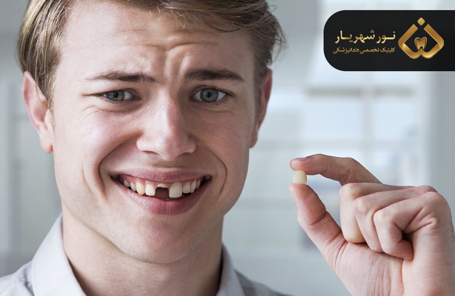 علل لق شدن دندان های دائمی چیست؟