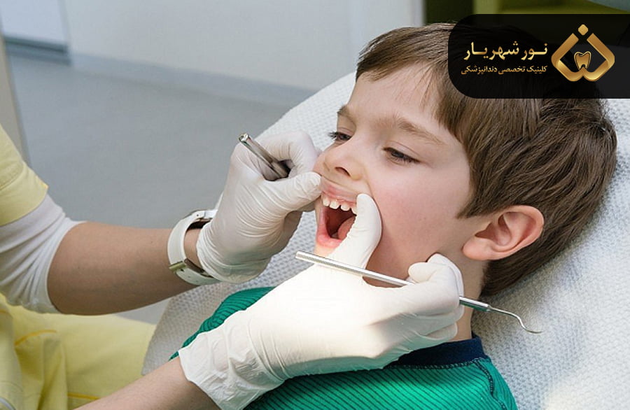 التهاب لثه در کودکان چیست؟