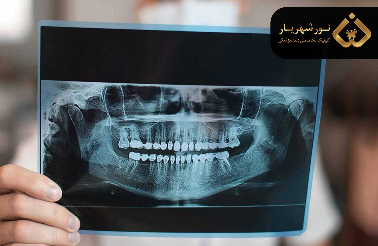 پوکی استخوان چیست؟