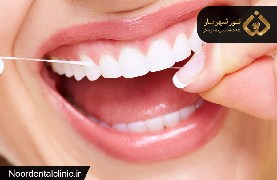فواید و نحوه‌ی صحیح استفاده از نخ دندان که باید بدانید