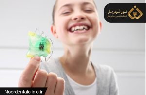 ارتودنسی پیشگیری در کودکان چیست و چه مزایایی دارد؟