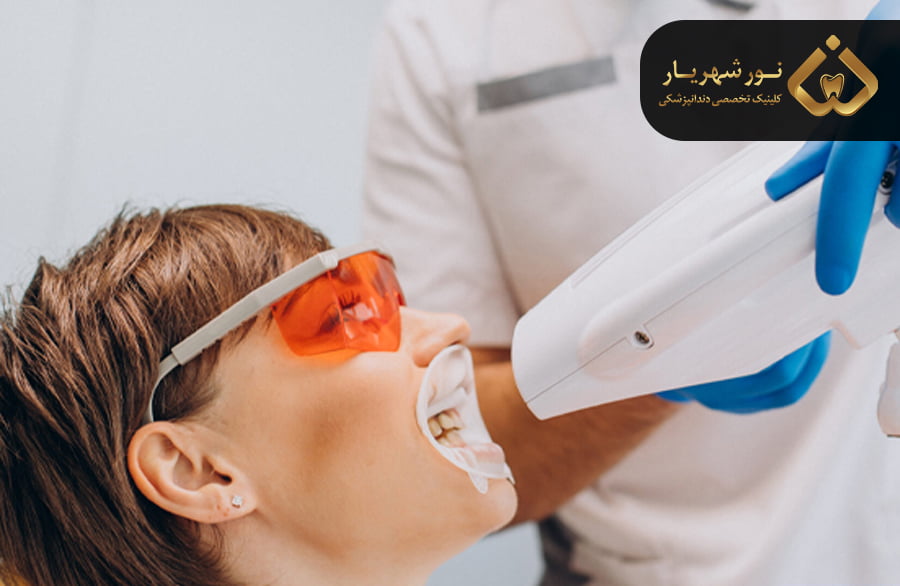 بلیچینگ دندان برای چه کسانی مناسب است ؟