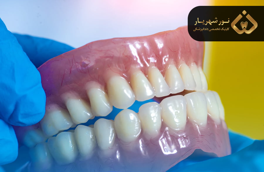دندان مصنوعی چیست؟