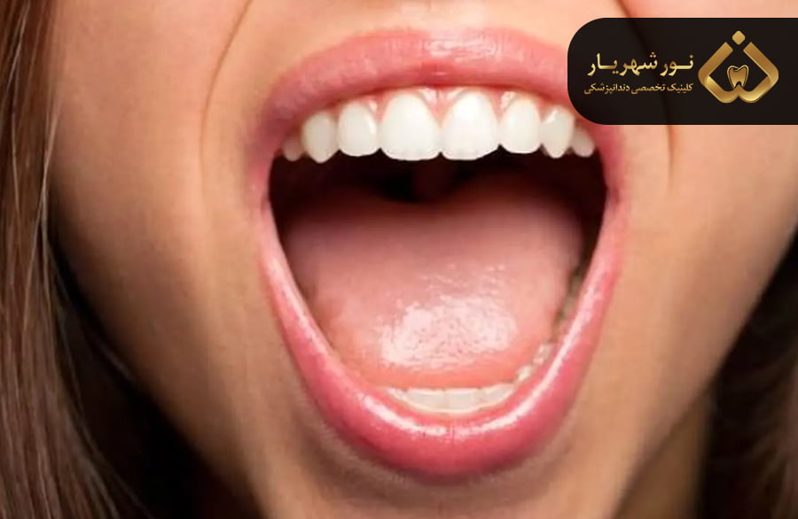 بهداشت نامناسب دهان و دندان