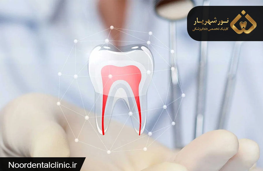متخصص درمان ریشه یا اندودنتیست