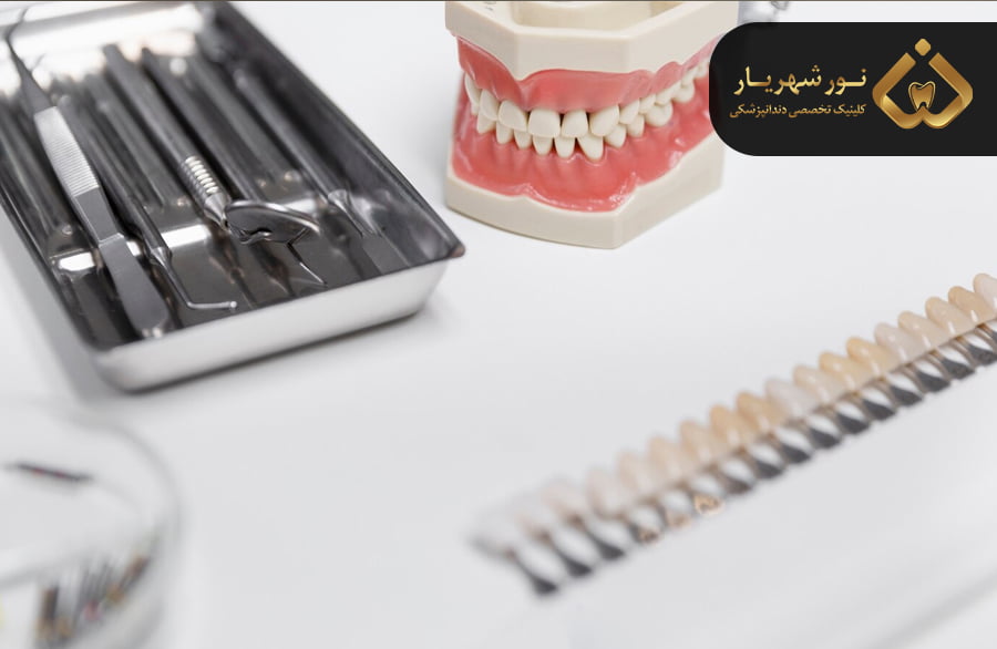 طول عمر کامپوزیت دندان بیشتر است یا بلیچینگ